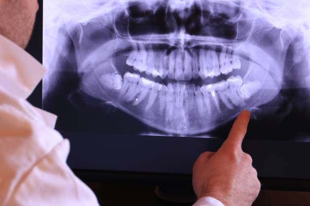 Best Pediatric Emergency Dentist in Weaverville, CA