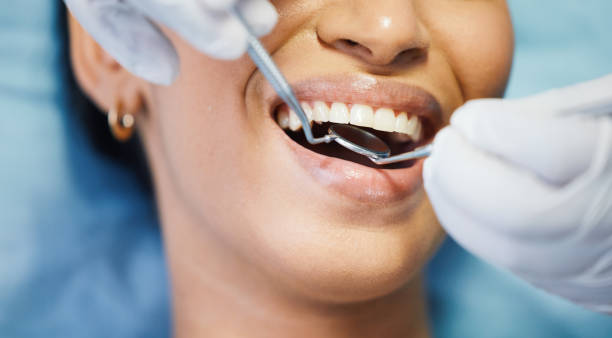 Best Emergency Dental Care for Abscessed Tooth in Weaverville, CA