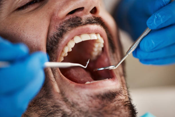 Best Pediatric Emergency Dentist in Weaverville, CA