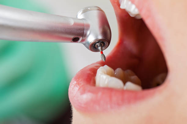 Best 24-Hour Emergency Dentist in Weaverville, CA